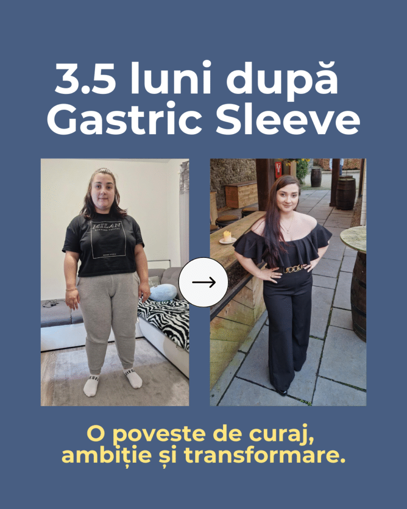 BA Daiana Gastric Sleeve Dr. Sever