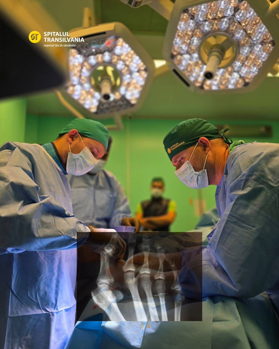 Monturi (hallux valgus) 6 Dr. Badiu Horațiu & Dr. Dîrlea Paul