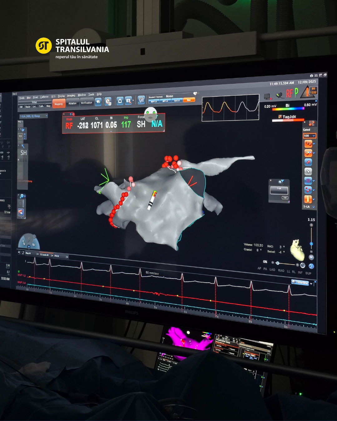 imagine din intervenție