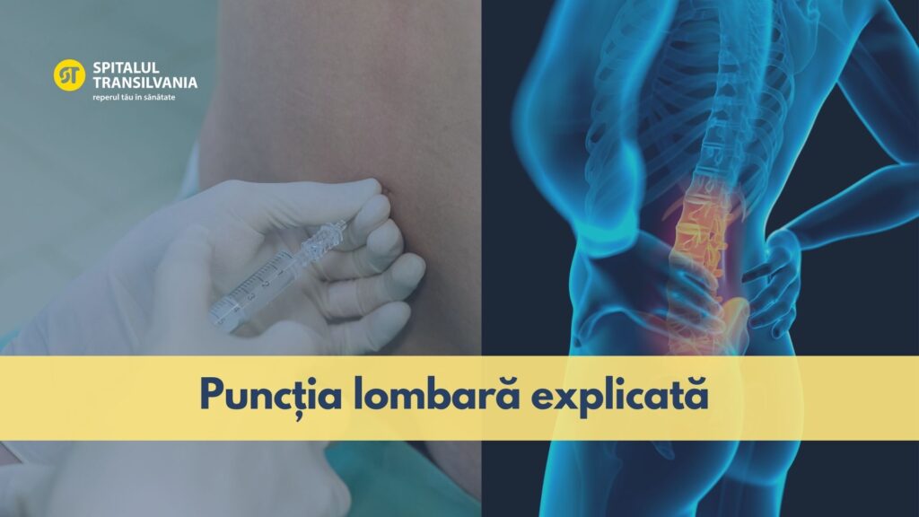 puncție lombară punctie lombara pret spitalul indicatii punctia lombara transilvania