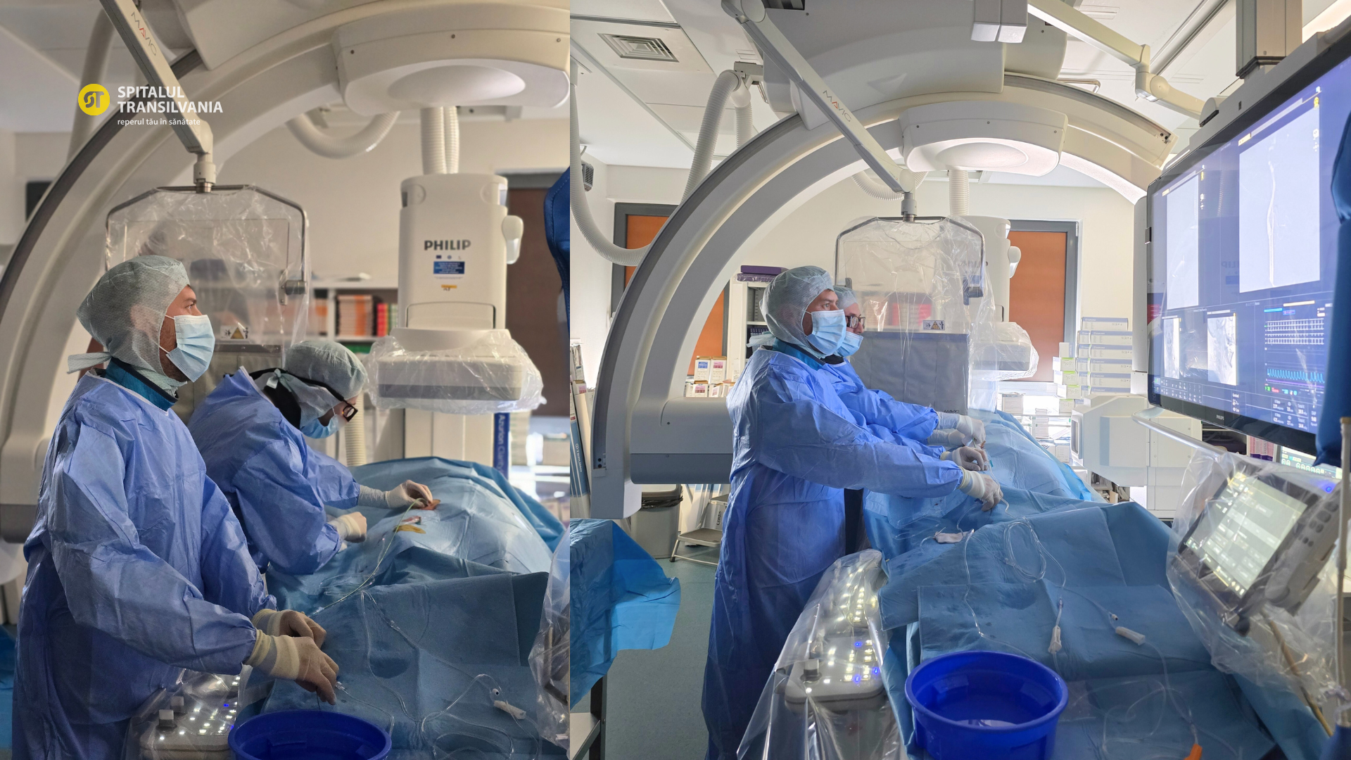 Angiografie cerebrală DSA pentru diagnosticarea fistulei durale arteriovenoase