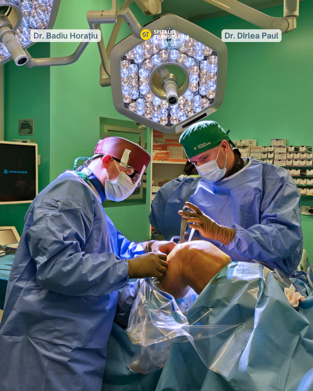 Osteotomia înaltă de tibie – o alternativă la proteza de genunchi pentru pacienții selectați 2 Cazuri SMM (3)