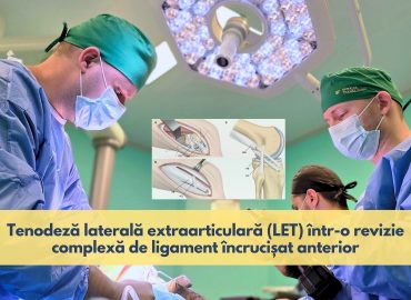 Intervenție de revizie a ligamentului încrucișat anterior și sutură meniscală realizată de echipa de ortopedie a Spitalului Transilvania