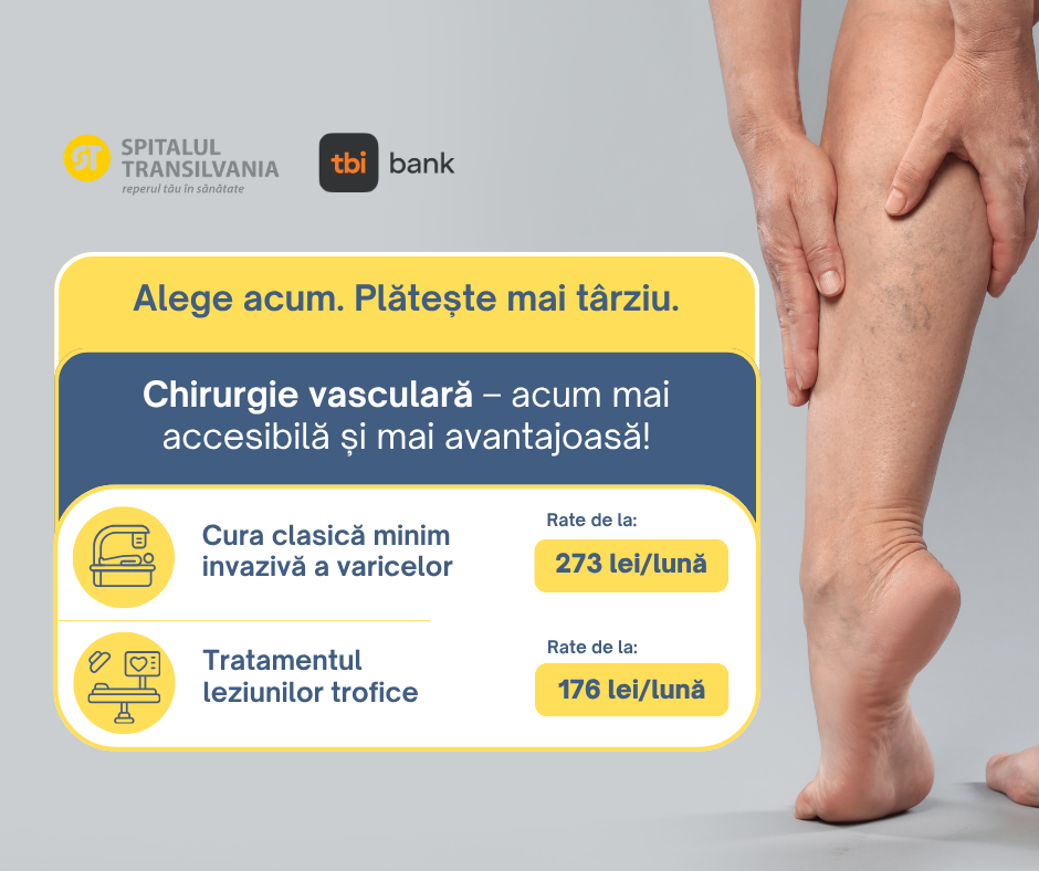 rate tbi bank pentru chirurgie vasculara